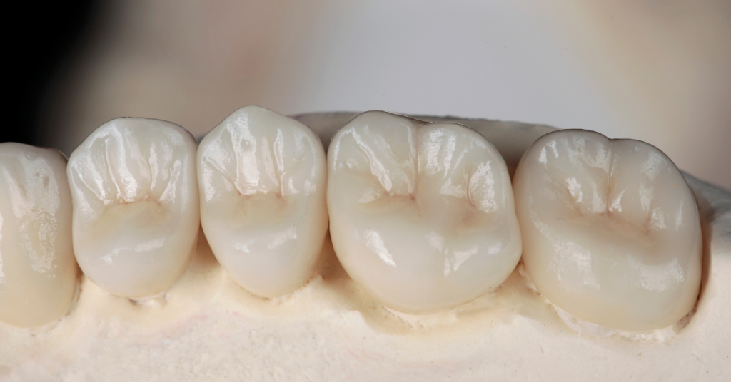 Dental Crowns - made from Zirconium Oxide