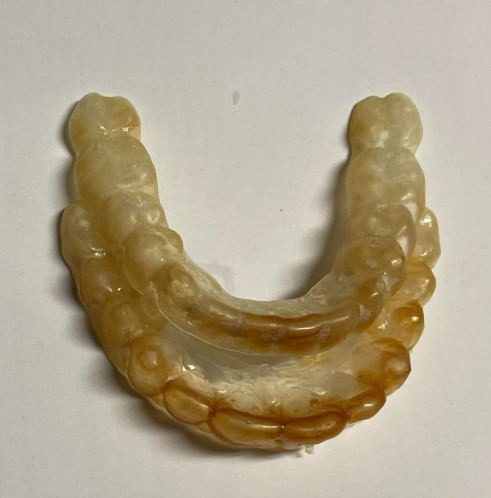 Dirty Dental Retainer