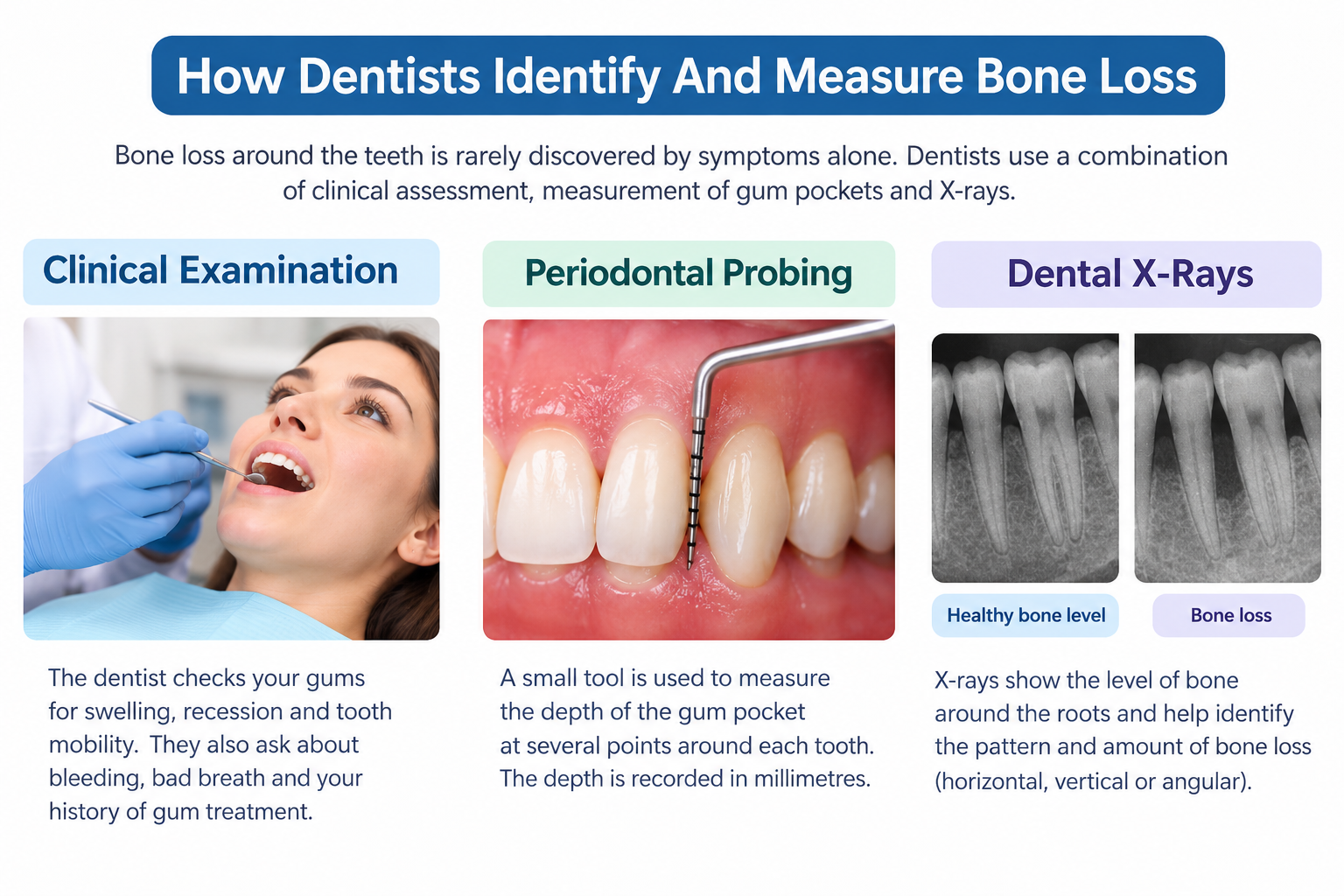 Gingivitis Versus Periodontitis